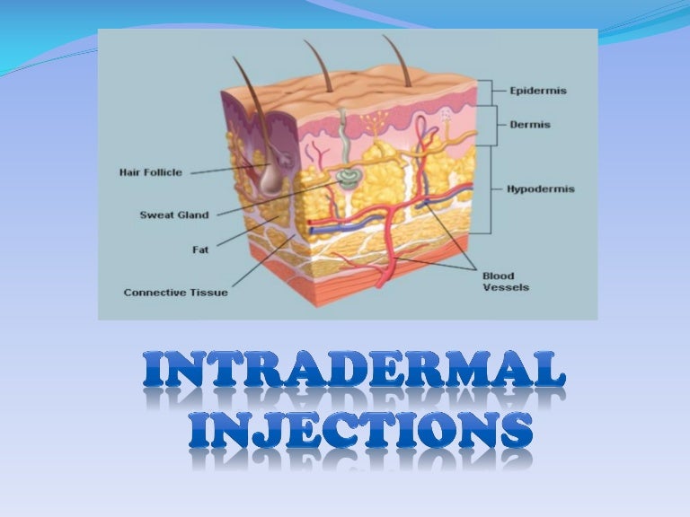 INTRADERMAL INJECTION