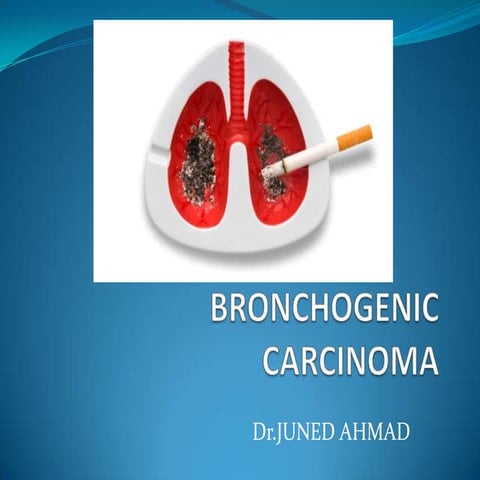 Ppt lung carcinoma part1