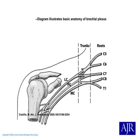 Brachial Plexus