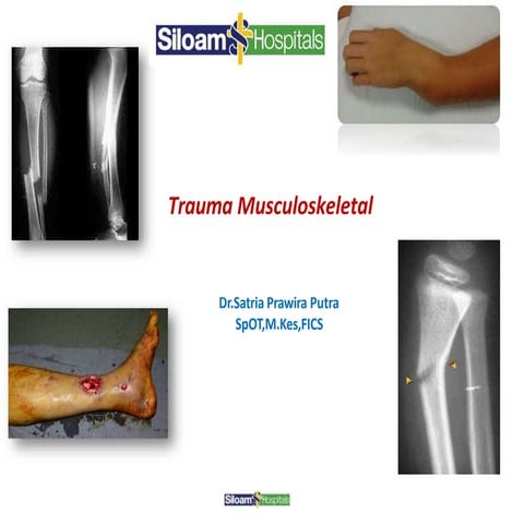 PPT trauma muskuloskeletal dr. Satria, Sp.OT.pptx