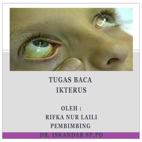 Comprehensive Overview of Ikterus (Jaundice): Causes, Types, and ...