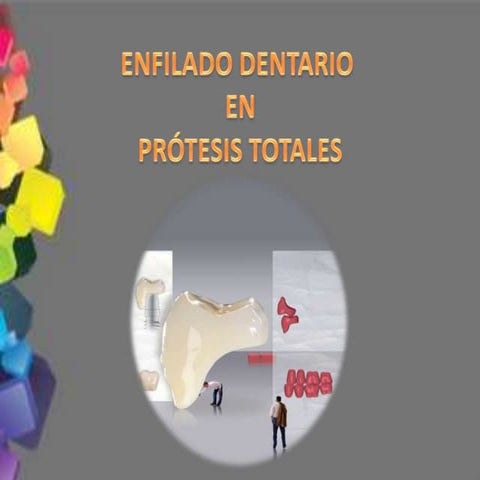 Enfilado dental final para prótesis total con técnicas combinadas | PDF