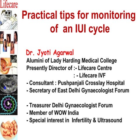 Practical tips for monitoring of an iui cycle Dr. Jyoti Agarwal | PPT