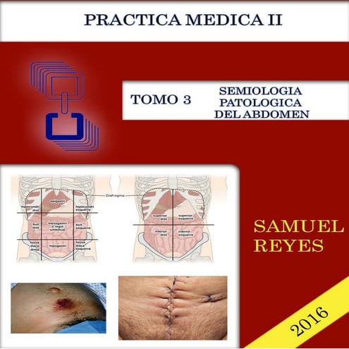 Abdomen agudo quirurgico | PPTX