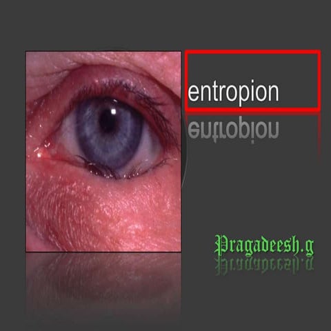ENTROPION