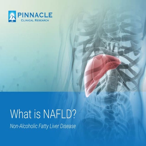 What is Non Alcoholic Fatty Liver Disease?