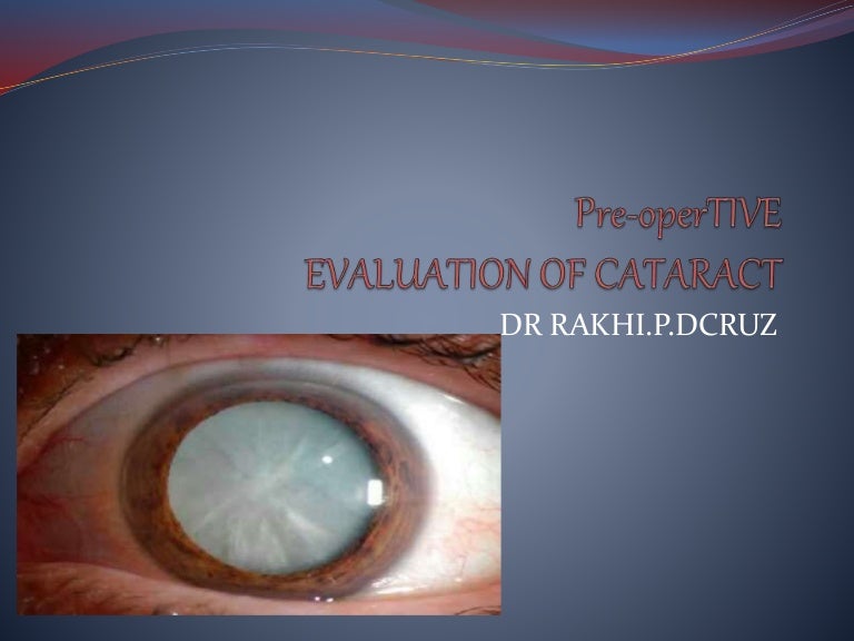 Pre operative analysis for cataract surgery