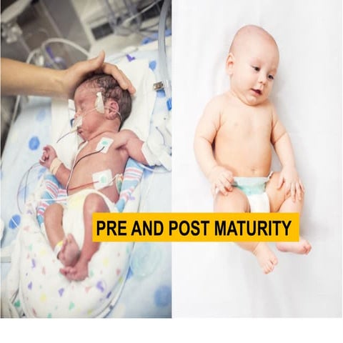 POST MATURITY in obstetrics and gynecology.pptx