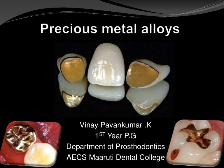 Precious metal alloys in dentistry