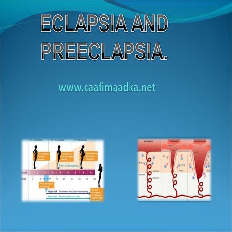 Preeclampsia and eclampsia | PPTX