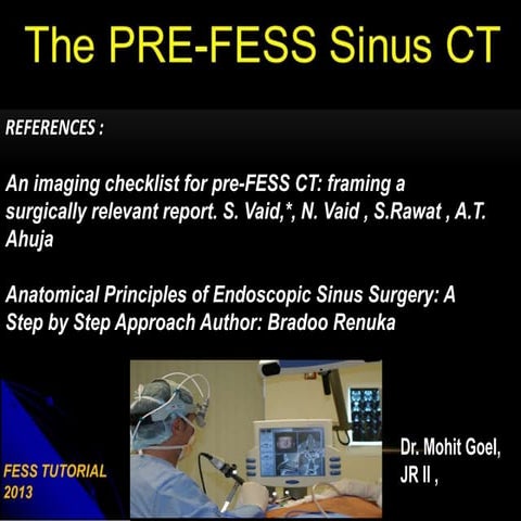 Pre-FESS PNS CT