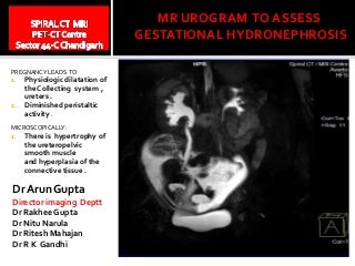 Pregnancy induced dilatation of the urinary system