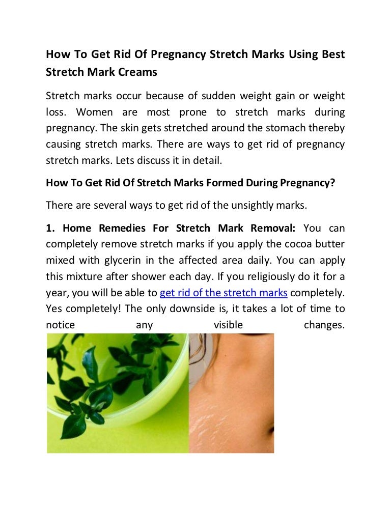 How To Get Rid Of Pregnancy Stretch Marks Using Best Stretch Mark Cre