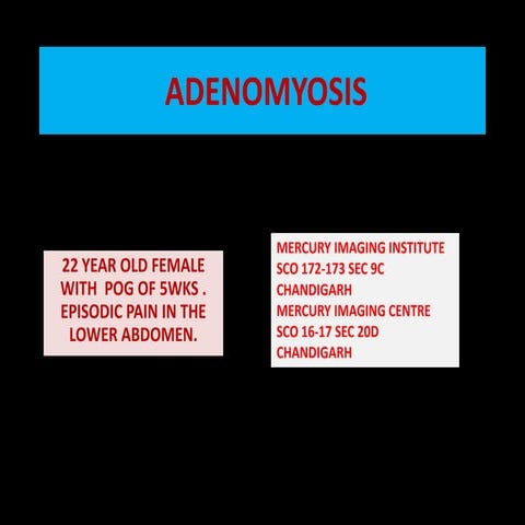 Pregnancy with adenomyosis  and leiomyoma with component of pelvic congestion 