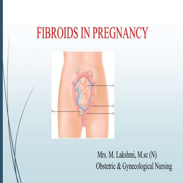 Pregnancy with fibroids 