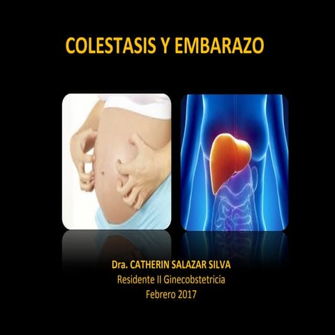 colestasis y embarazo | PPT