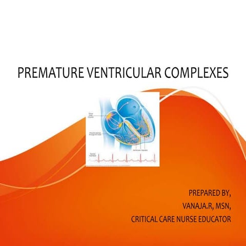 Pre mature ventricular complex