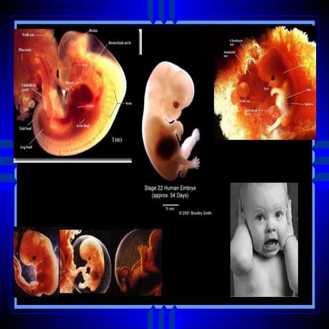 Prenatal[2] | PPT