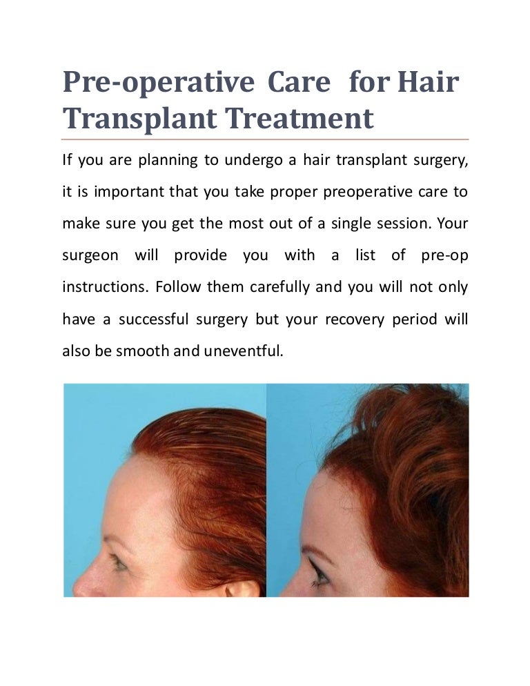 Preoperative Care for Hair Transplant Treatment Saudi Arabia