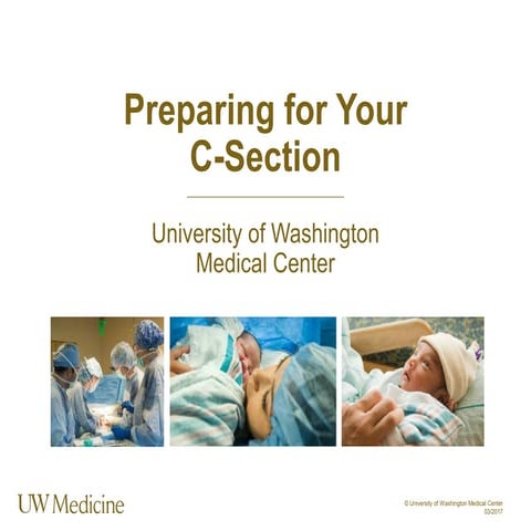 Prepare you Cesarean section in UW Medicine | PDF