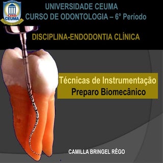 Preparo biomecânico  