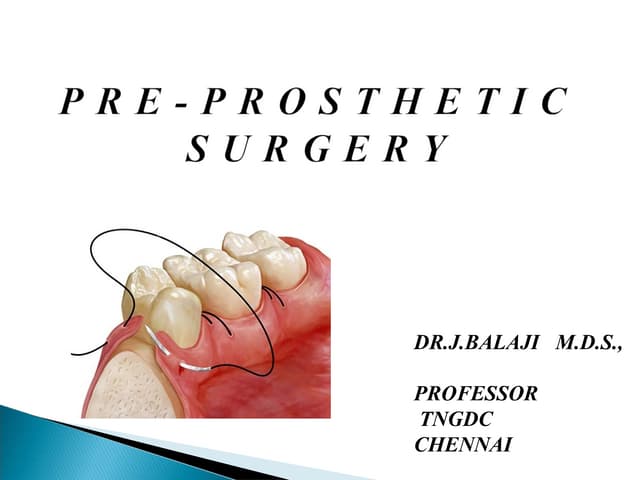 PREPROSTHTIC SURGERY In oral surgery and endo