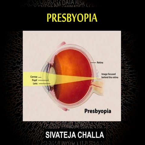 Presbyopia