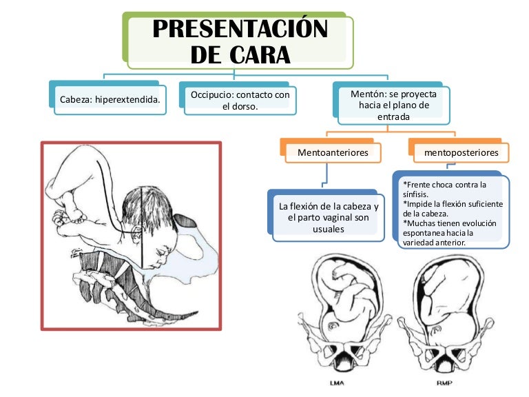Presentacion De Cara En El Parto