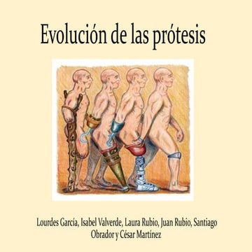 Evolución de las prótesisi