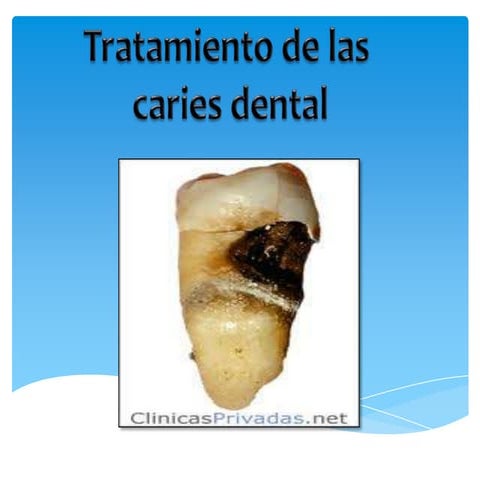 Presentación1 taratmkiento