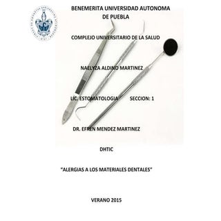  Alergias a los materiales dentales