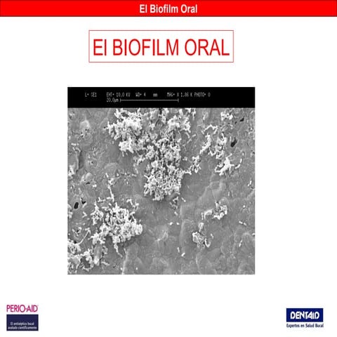 BIOFINDER CIP: SONDA DETECCION BIOFILMS EN CIRCUITOS CERRADOS | PDF