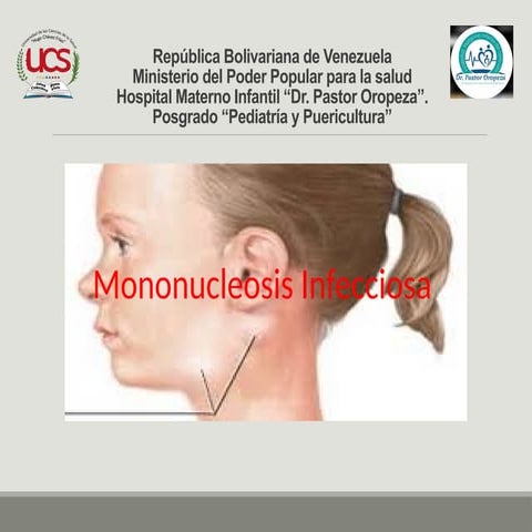 La mononucleosis | PPTX