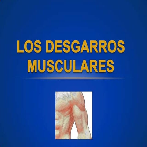 Desgarros musculares
