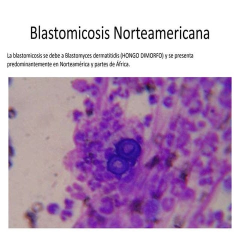 Presentacion de patologia