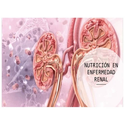 Presentación introducción ERC en nutrición