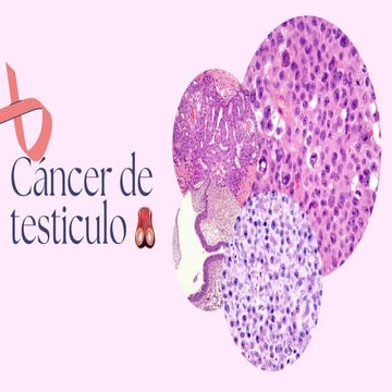 Comprehensive Overview of Testicular Cancer Types, Diagnosis, and Risk ...
