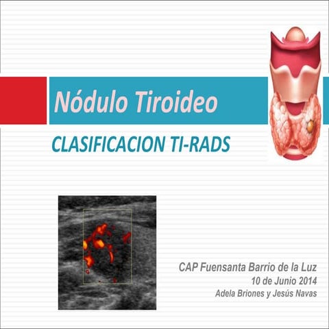 Nódulo tiroideo clasificación Ti-rad | PPT