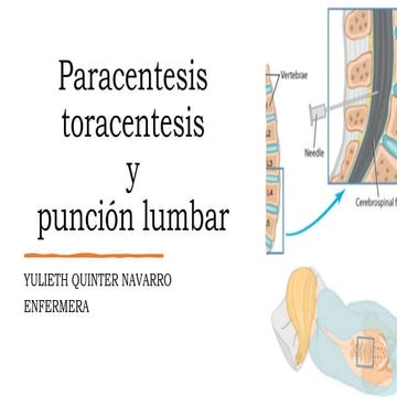 PRESENTACION TORACENTESIS , PARACENTESIS Y PUNCION LUMBAR EN ENFERMERIA ...