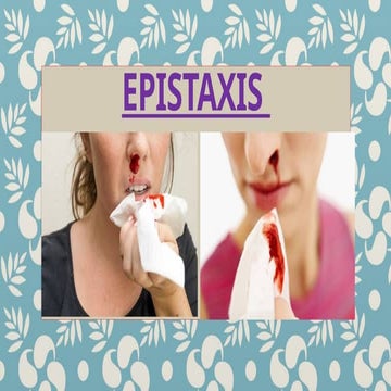 Epistaxis { Nose bleeding}pptx..........