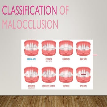 Classification of malocclusion various types of malocclusion