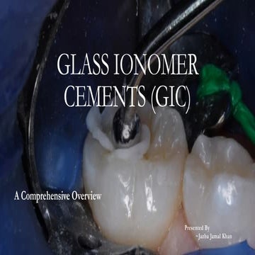 Glass Ionomer Cement presentation for dental students | PPTX