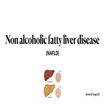 Non - Alcoholic Fatty Liver Diseases.pdf