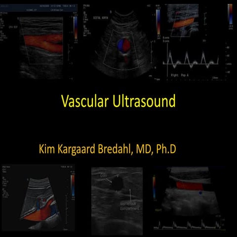presentation-kim-bredahl-doppler-ultrasound.pdf