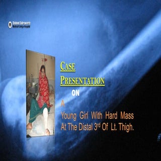 "Osteosarcoma"- Case Presentation