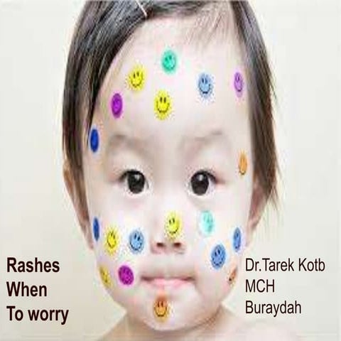 rashes when to worry