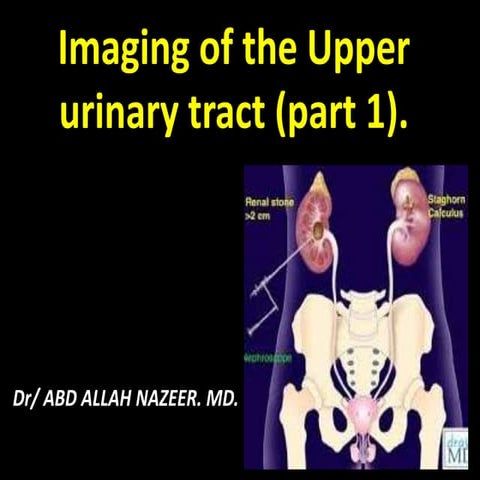 Presentation1.pptx,  imaging of the urinary system.