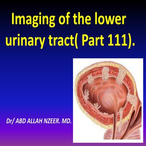 Presentation1.pptx, imaging of the lower urnary system