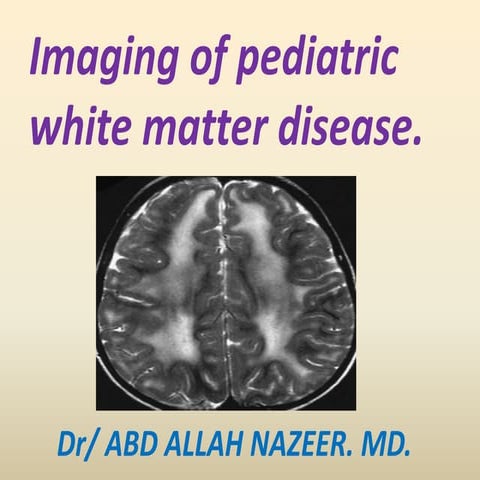 Presentation1.pptx white matter disorder in pediatric