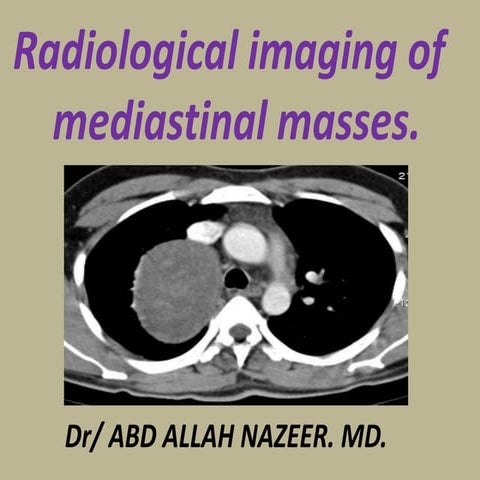 Presentation1.pptx radiological imaging of mediastinal masses .